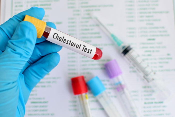 Cholesterin-Check muss schnell sein