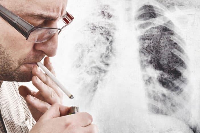 Symptome von Lungenkrebs