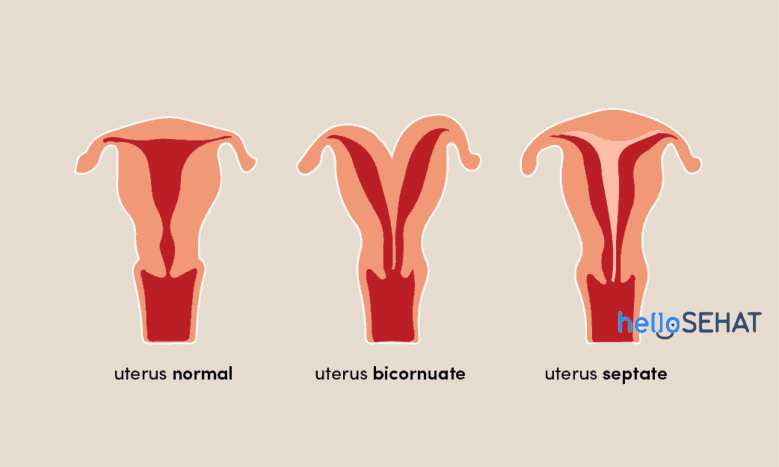 Anomalien in der Gebärmutter