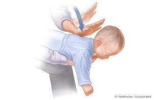 Schritte zum Ersticken von Babys (1-3) Quellen: www.webmd.com
