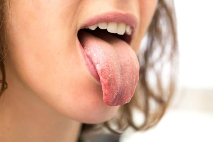 die Ursache für Zungenjucken