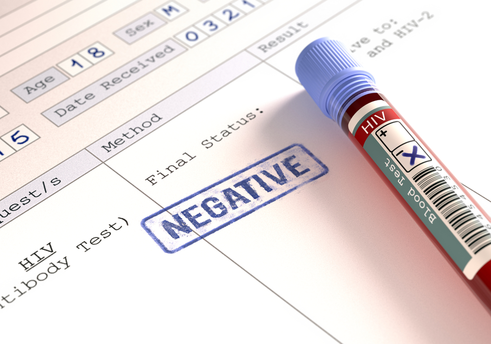 die Bedeutung der Ergebnisse eines negativen HIV-Tests