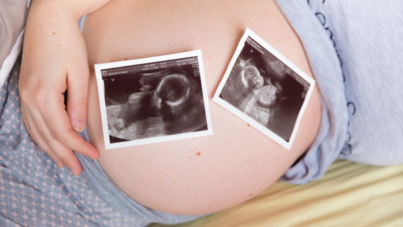 Das Risiko, mit Zwillingen schwanger zu werden, verschwindet