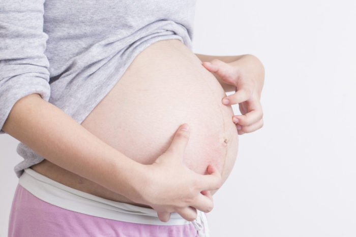 Juckende Follikulitis ist die Ursache für juckende Haut während der Schwangerschaft