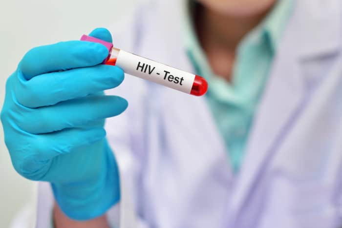 HIV-Bluttest